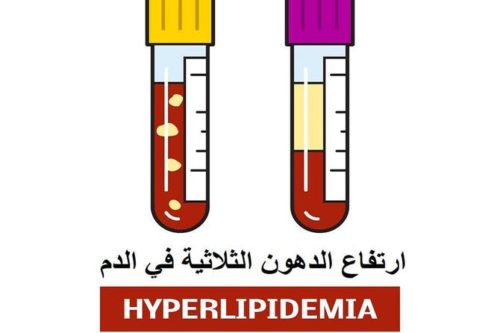علاج الدهون الثلاثية