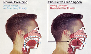 sleep=