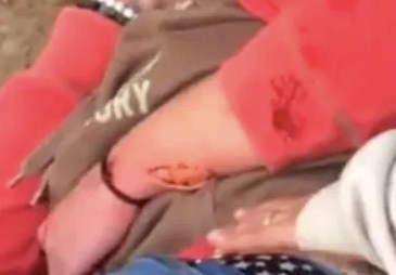 Women taken to hospital after attack 