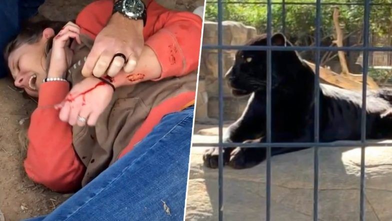 Women hand bleeding after jaguar attack