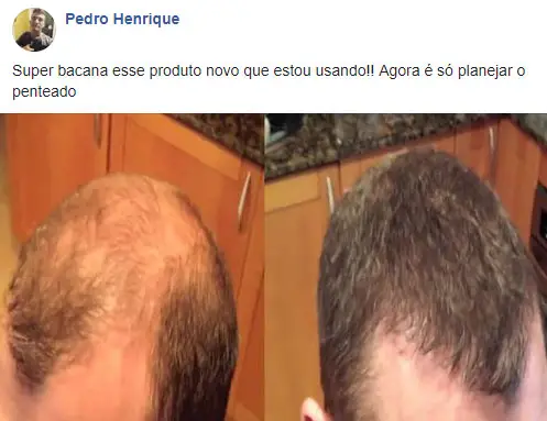 Folixil Depoimentos Composi&ccedil;&atilde;o