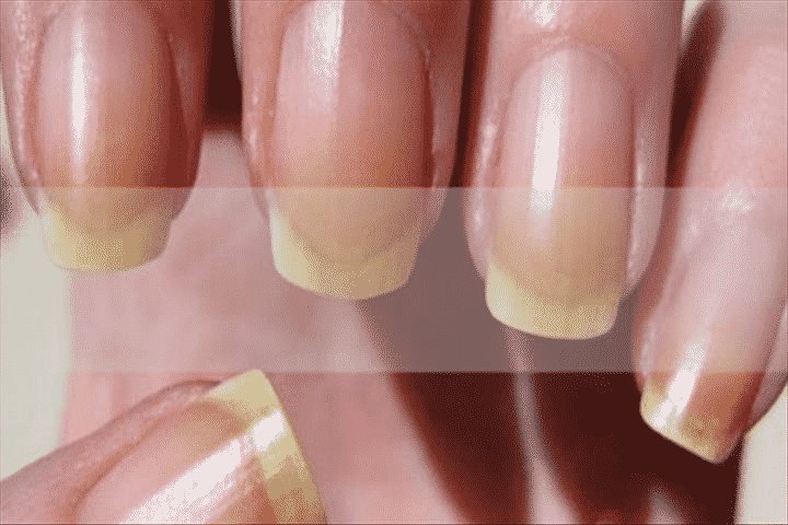 Sinais das unhas das m&atilde;os para a sua sa&uacute;de