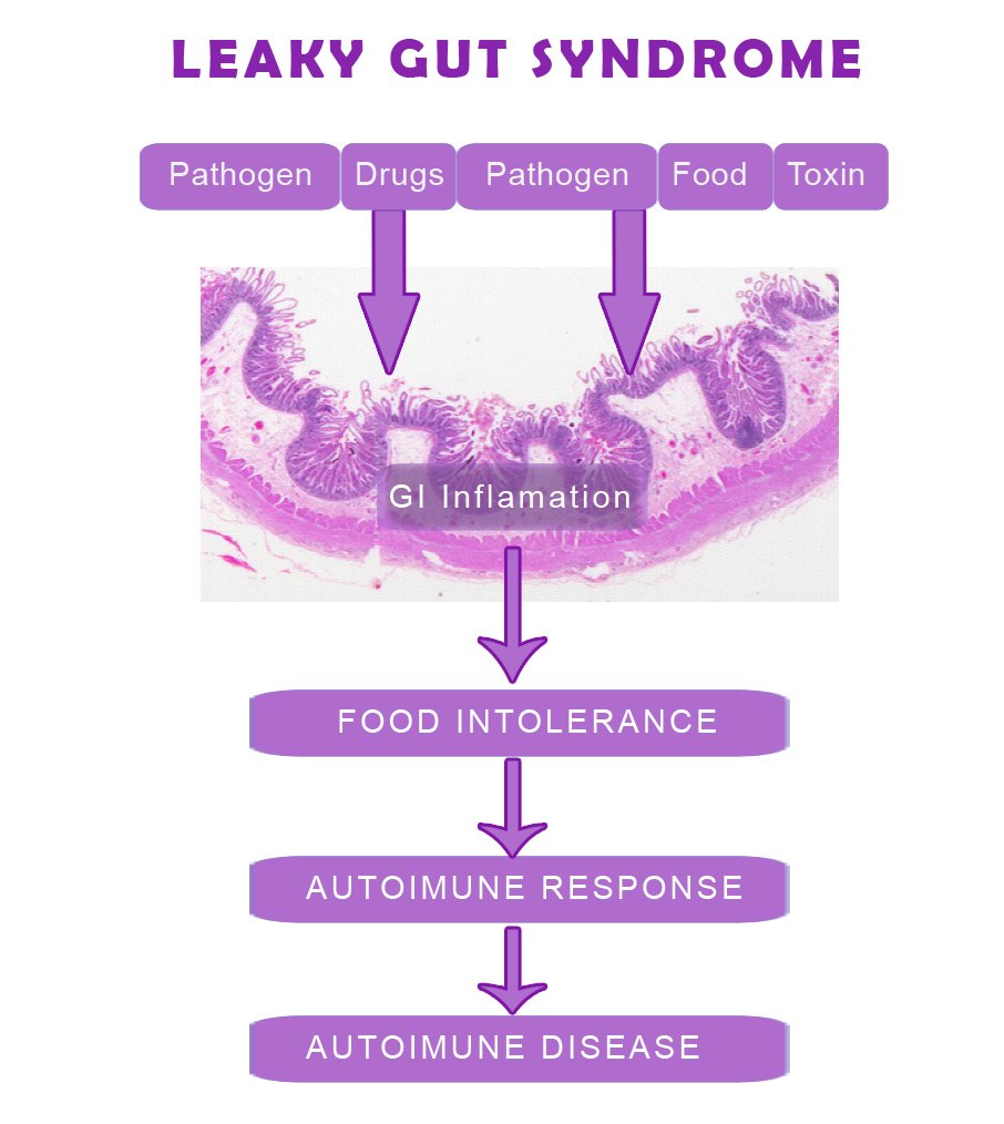 How to Heal Leaky Gut Syndrome