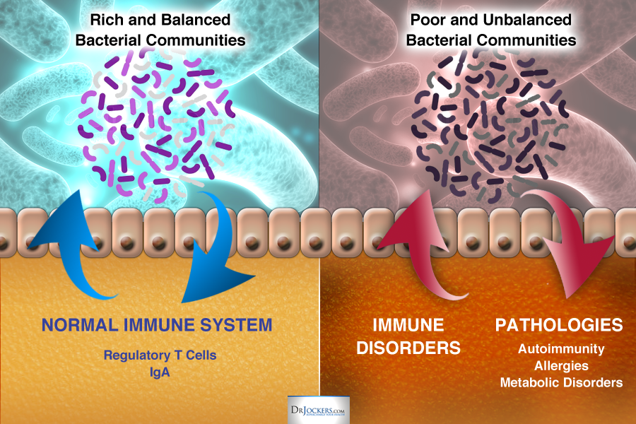 Top 10 Foods to Heal Leaky Gut Syndrome