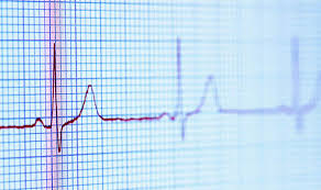 how to stop ectopic beats